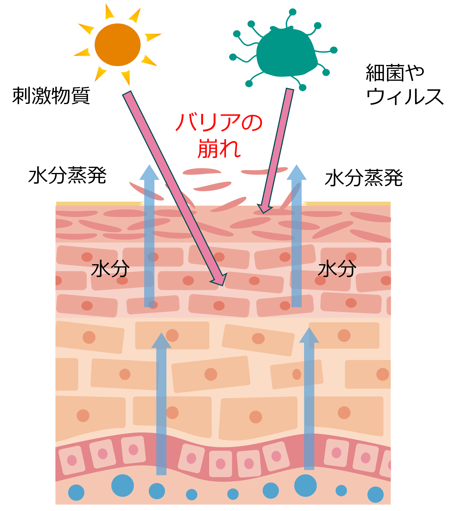 バリア機能が低下した肌のイラスト