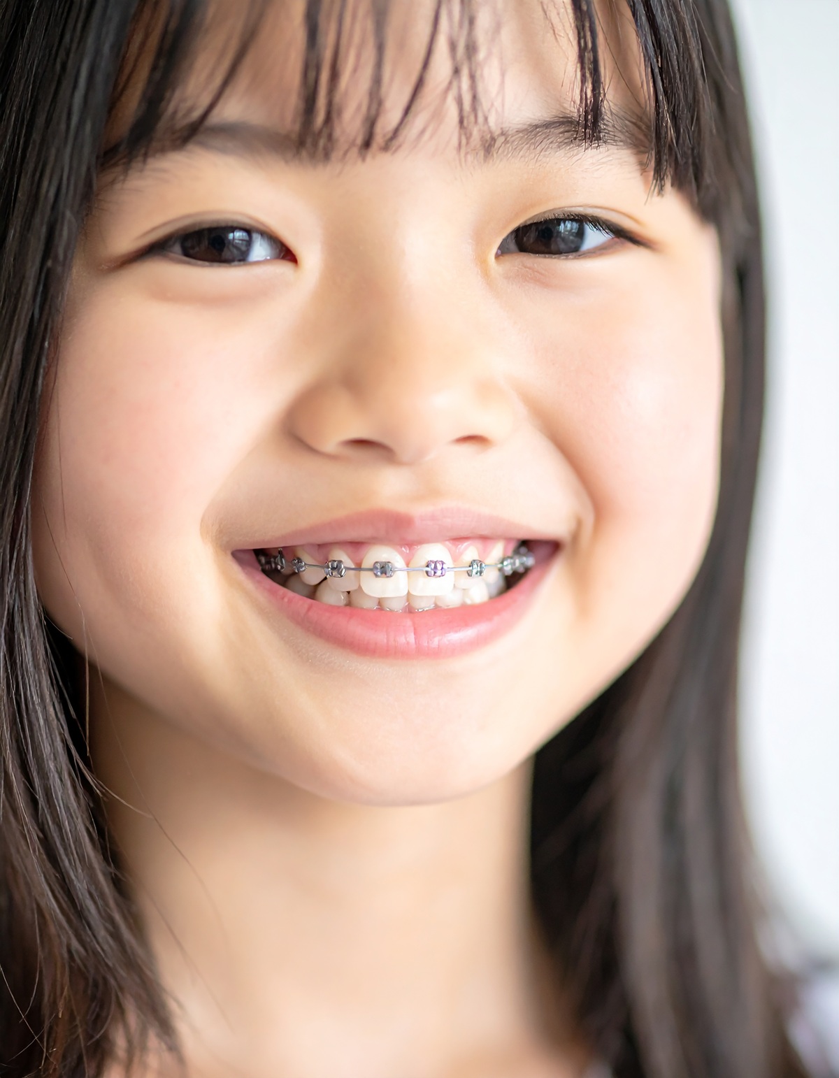 矯正歯科（子供から大人まで）